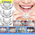 Miniatyrbild 1 av 5: 3 Steg Tand Ortodontisk Tränare Dental Tandställning Justering Fz5-2