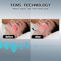 Miniatyrbillede 2 af 5: Smart Anti-Snorke Enhed, Elektrisk Snorke Stopper Enheder EMS Hals Massager, Komfortabel Stop Snorke Hjælpemiddel Løsning for Bedre Søvn