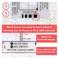 Miniatyrbillede 5 af 5: 2 stk. EKG 7-trins lineal, EKG 7-trins lineal til EKG/EKG-fortolkning, EKG-lineal, bærbar EKG-vurdering