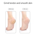 Miniatyrbillede 5 af 5: Exfoliator Pedicure Værktøj Fod Pimpsten Svampe Hård hud Fjerner 2stk