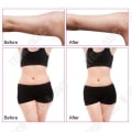 Miniatyrbillede 2 af 4: Ultralydmaskine til cavitation og fjernelse af cellulite, fedtkrop R.F skønhedsmaskine til ansigtsløftning EU-stik