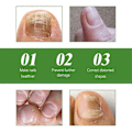 Miniatyrbild 4 av 5: 1-3 st Nageloljeroller - Näringsgivande Massage För Starkare, Snabbare Växande Naglar Med 7-dagars Nagelväxtformula 2pcs