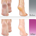 Miniatyrbilde 4 av 6: Fotfil, Nano Glass Callus Remover og Negleklipper-Fot