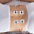 Miniatyrbilde 2 av 5: 5*5cm 20 Pads Stud TENS SELVKLÆBENDE Pads PASSER TIL BEURER Tens Unit Pads Udskiftning Tens Elektroder Genanvendelige til Elektroterapi Massage (Hvid)