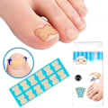 Miniatyrbild 3 av 5: 120 st Limfri Inväxt Nagelpasta Inväxt Nagelkorrigeringsverktyg