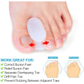 Miniatyrbilde 5 av 5: 10 Pakke Tåspredere Separatorer, Hallux Valgus Korrigerende Gel Ortopediske Innlegg (1/2'' Tykk) for Hallux Valgus, Overlappende Tær - L Størrelse