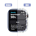 Miniatyrbilde 4 av 5: Bling-deksel kompatibel med Apple Watch Series 3 2 1 42mm skjerm
