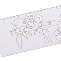 Miniatyrbild 6 av 7: Multi-linjal Goniometer Vinkellinjal Ortopedi verktygsinstrument 1pc