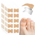 Miniatyrbild 1 av 5: Behandling av nageltrång, 100 st andningsbara korrigeringsplåster, smärtfri nagelkorrigering, nageltrångremsor, behandling av nageltrång