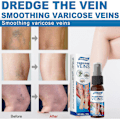 Miniatyrbillede 4 af 5: 30ml Åreknuder Massage Smooth Ven Legs Revitaliserende Spray