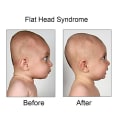 Miniatyrbilde 4 av 5: Baby mot flatt hode-deformasjon Flat hodeform Memory Foam pute Liten baby for baby (rosa) NO:9