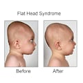 Miniatyrbillede 4 af 5: Baby mod fladt hoved deformering Fladt hovedform Memory Foam pude Lille baby til baby (pink) NO:9