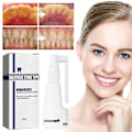 Miniatyrbild 1 av 4: 30ml Calculus Dissolving Dental Spray Oral Tooth Cleaner Tartar Remover null none