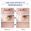 Miniatyrbild 3 av 5: Eelhoe Water Light Cono Peptide Anti-rynk Essence null none