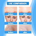 Miniatyrbild 3 av 3: Oligopeptide Small Bubble Cleansing Essence 2ml*5