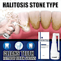 Miniatyrbild 2 av 4: 30ml Calculus Dissolving Dental Spray Oral Tooth Cleaner Tartar Remover null none