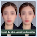 Miniatyrbild 5 av 5: Huamade 30st/set Silikon Elf Ear Stick Lift för öronsnibbstödtejp null none