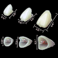 Miniatyrbillede 2 af 3: Midlertidige kroner, porcelæn, anteriore veneers, til tandlæger, 72 stk./æske_FC31 (W)