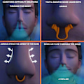 Miniatyrbillede 3 af 3: 3 stk. Anti-Snorken Næsedilatator Transparent - Næseånding Medium - Forebyggelse af Tilstoppet Næse