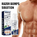 Miniatyrbilde 1 av 5: Razor Bump Stopper med behandling for inngrodde hår, behandling for barberingsnupper for kvinner og menn, After Shave-løsning for inngrodde hår og barberingsbrann