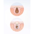 Miniatyrbillede 3 af 7: Ansiktssauna Facial Care Lanaform Multicolor