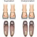 Miniatyrbillede 2 af 5: Korrigerende skoindlæg til supination og overpronation