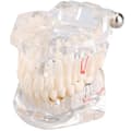 Dentalmodell käke med 14 uttagbara tänder 10x7,5x6,5 cm