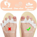 Pikkukuva 5 / 5: 2 Paria Silikonivarvaserottimia, Varpaiden Suojaus, Hallux Valgus -Korjaus