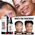 Miniatyrbilde 5 av 5: Hvit Flekk Reduserende Spray - Vitiligo Behandling