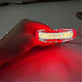 Miniatyrbillede 3 af 5: Mundsår Kur Lindring Gingivitis Terapi Led Rødt Lys Terapeutisk Apparat Qcl (FMY)