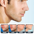 Miniatyrbillede 3 af 5: East Moon Tynd Jawbone Essence Fastgørende Ansigtshud Vis Jawbone Nedre Jaw Line V Face Essence