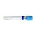 Miniatyrbillede 3 af 5: 2x 10ml Syre Gel Bund Negativ Tryk Plast Rør Blodplade Plasma Opsamling Og Måling T