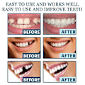 Miniatyrbild 5 av 5: Justerbara Snap-on Proteser, Veneer Proteser Tandställning Plus Proteser Fodral, Tillfälliga Fyllningar Tandställning Interdental Fyllningar Rätande Proteser Kit