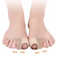 Pikkukuva 3 / 7: Hallux Valgus - Isovarpaan erotin Beige 1-pack