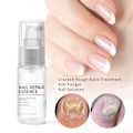 Pikkukuva 5 / 8: Nail Care Liquid Exfoliate Improve Halkeilevia ja karkeita kynsiä korjaava geeli sormenkynsille varpaankynsille 20 ml