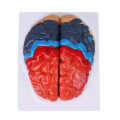 Miniatyrbilde 3 av 8: Anatomisk menneskelig hjernemodell Cerebral arteriefarge oppdelt venstre høyre hjernemontert modell for læring