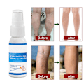 Miniatyrbillede 4 af 6: Åreknudespray Antiinflammatorisk Effektiv Åreknudespray