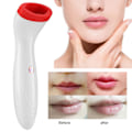 Miniatyrbilde 6 av 8: USB Oppladbar Automatisk Lip Plumper Instrument Elektrisk Lip Enhancer Plumping Device