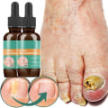 Miniatyrbilde 8 av 8: 30ml Nail Fungal Liquid Anti Fungal Nail Solution for finger- og tånegler