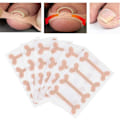 Miniatyrbillede 1 af 5: Neglekorrektionssticker, 24 stk. - Effektiv behandling af paronyki med fodplejeværktøj, smertelindring