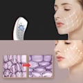 Miniatyrbild 5 av 5: V Face Shaping Massager Bluetooth Fjärrkontroll Double Chin Reducer Smart Face Lifting Machine for Home White
