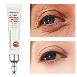 Magic Eye Cream Instant Remove Eye Bags Dark Anti Wrinkle