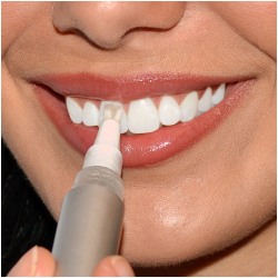 Tandblekningspenna SmileKit 2-pack