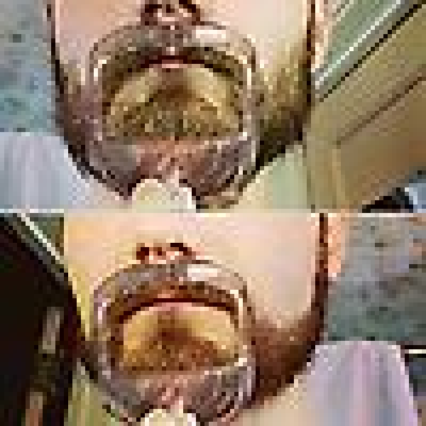 （Vit）5 storlekar Goatee Rakning Mall Beard Guide Shaper Beard S