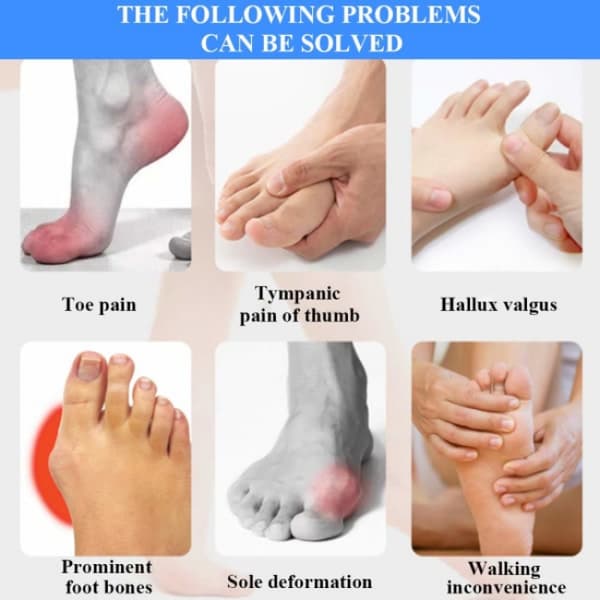 4 stk Hallux Valgus Ortose Korrigerer Tå Tå Separator 4PCS Tå S