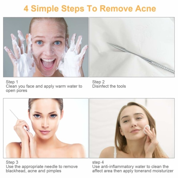 Pore ​​Worm Remover Kit med 10 deler i rustfritt stål