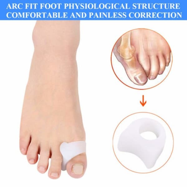 4 stk Hallux Valgus Ortose Korrigerer Tå Tå Separator 4PCS Tå S