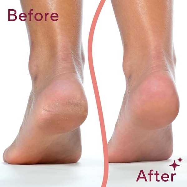 Finishing Touch Flawless Pedi Elektroninen jalkaraspi ja kovettumien poistaja, pedikyyri - Uusi versio