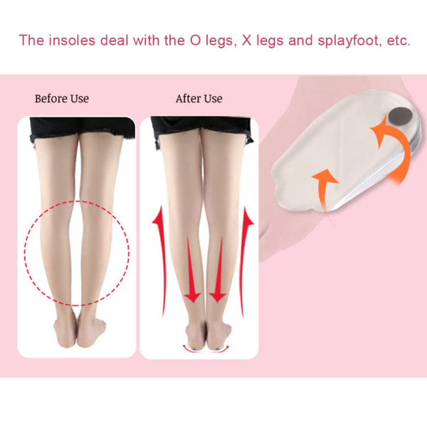3 paria geelimäisiä O/X jalkakorjauspohjallisia Magneettinen jalka ortoosikaaren tuki Naisten Miesten kantapäätyynyt (35-39)