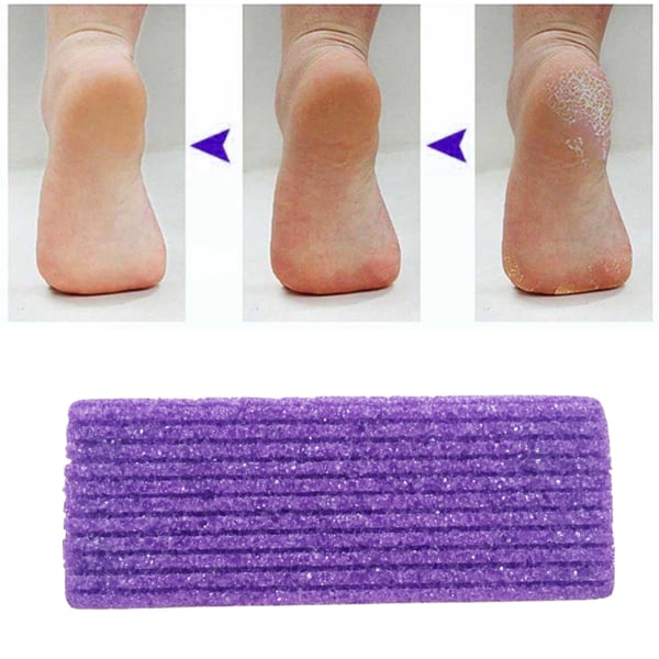 2 in 1 hohkakivi jalkakivi kovan ihon kovettumat poisto pedikyyrityökalut jaloille
